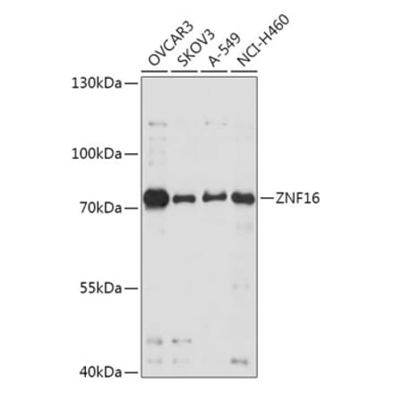 Western Blot - Anti-ZNF16 Antibody (A307640) - Antibodies.com