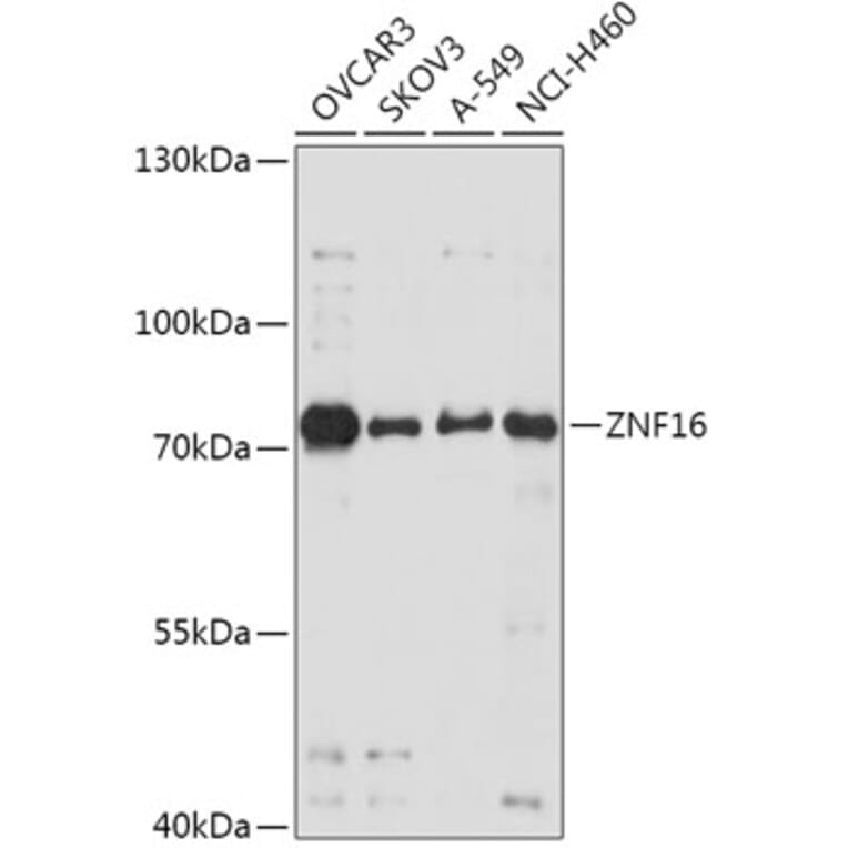 Western Blot - Anti-ZNF16 Antibody (A307640) - Antibodies.com