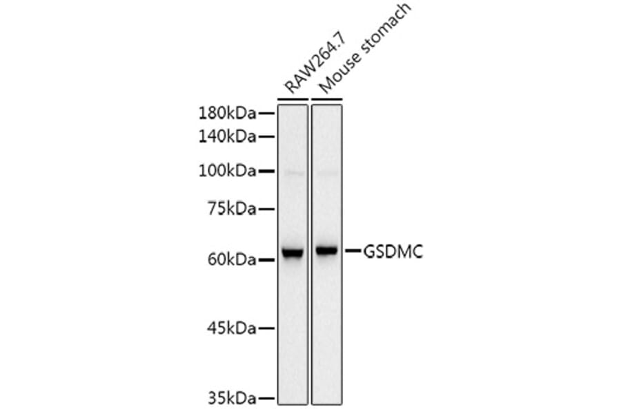 Western Blot - Anti-GSDMC Antibody [ARC52482] (A307641) - Antibodies.com