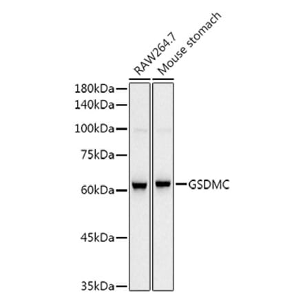 Western Blot - Anti-GSDMC Antibody [ARC52482] (A307641) - Antibodies.com