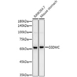 Western Blot - Anti-GSDMC Antibody [ARC52482] (A307641) - Antibodies.com