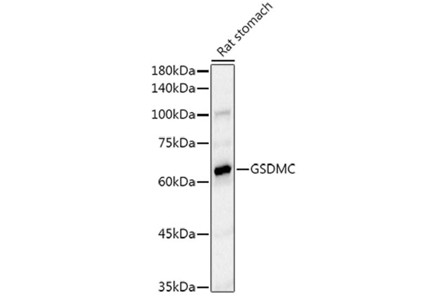 Western Blot - Anti-GSDMC Antibody [ARC52482] (A307641) - Antibodies.com