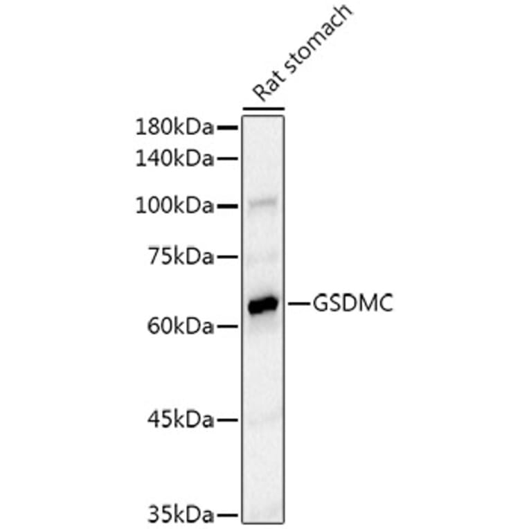 Western Blot - Anti-GSDMC Antibody [ARC52482] (A307641) - Antibodies.com