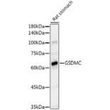 Western Blot - Anti-GSDMC Antibody [ARC52482] (A307641) - Antibodies.com
