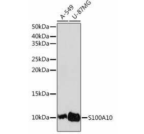 Western Blot - Anti-S100A10 Antibody [ARC0720] (A307642) - Antibodies.com