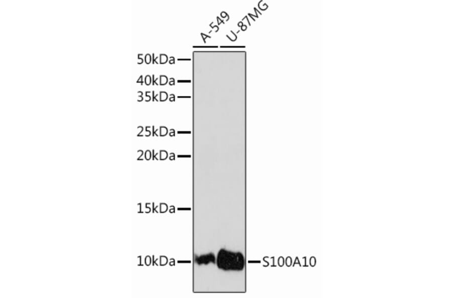 Western Blot - Anti-S100A10 Antibody [ARC0720] (A307642) - Antibodies.com