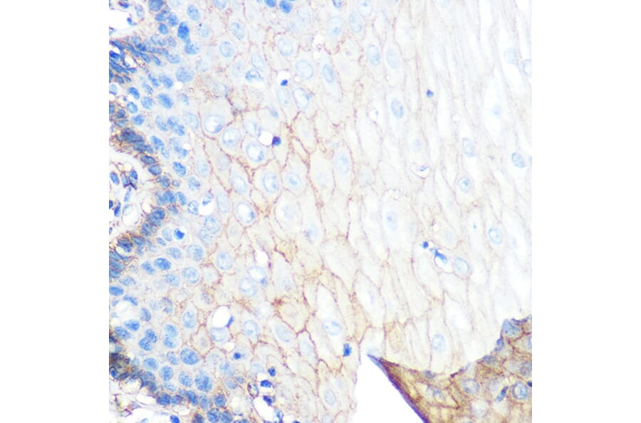 Immunohistochemistry - Anti-S100A10 Antibody [ARC0720] (A307642) - Antibodies.com