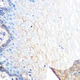 Immunohistochemistry - Anti-S100A10 Antibody [ARC0720] (A307642) - Antibodies.com