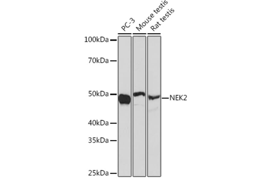 Western Blot - Anti-NEK2 Antibody [ARC1418] (A307643) - Antibodies.com
