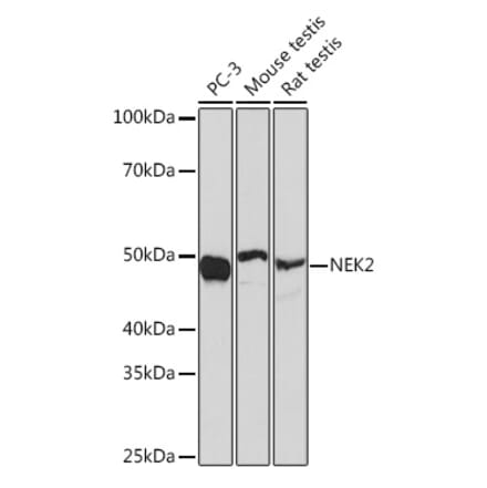 Western Blot - Anti-NEK2 Antibody [ARC1418] (A307643) - Antibodies.com