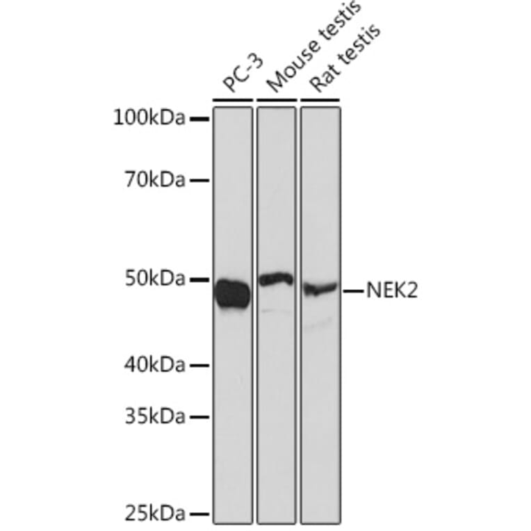Western Blot - Anti-NEK2 Antibody [ARC1418] (A307643) - Antibodies.com