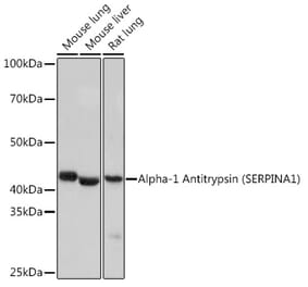 Western Blot - Anti-alpha 1 Antitrypsin Antibody [ARC1212] (A307644) - Antibodies.com