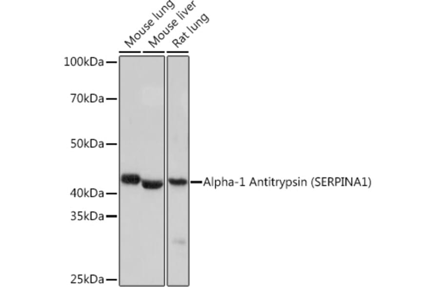 Western Blot - Anti-alpha 1 Antitrypsin Antibody [ARC1212] (A307644) - Antibodies.com