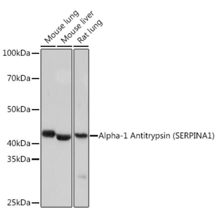 Western Blot - Anti-alpha 1 Antitrypsin Antibody [ARC1212] (A307644) - Antibodies.com