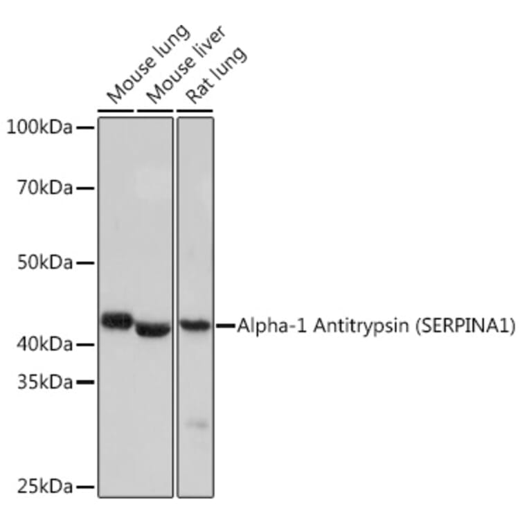 Western Blot - Anti-alpha 1 Antitrypsin Antibody [ARC1212] (A307644) - Antibodies.com