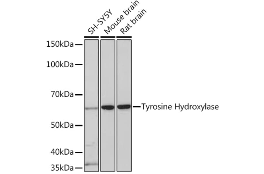 Western Blot - Anti-Tyrosine Hydroxylase Antibody [ARC1184] (A307645) - Antibodies.com