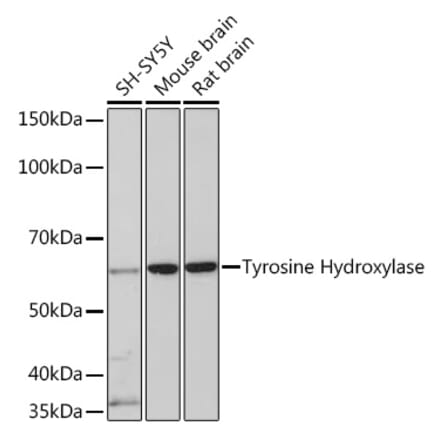 Western Blot - Anti-Tyrosine Hydroxylase Antibody [ARC1184] (A307645) - Antibodies.com