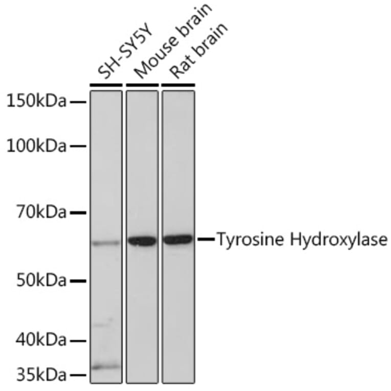 Western Blot - Anti-Tyrosine Hydroxylase Antibody [ARC1184] (A307645) - Antibodies.com