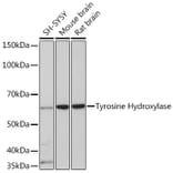 Western Blot - Anti-Tyrosine Hydroxylase Antibody [ARC1184] (A307645) - Antibodies.com