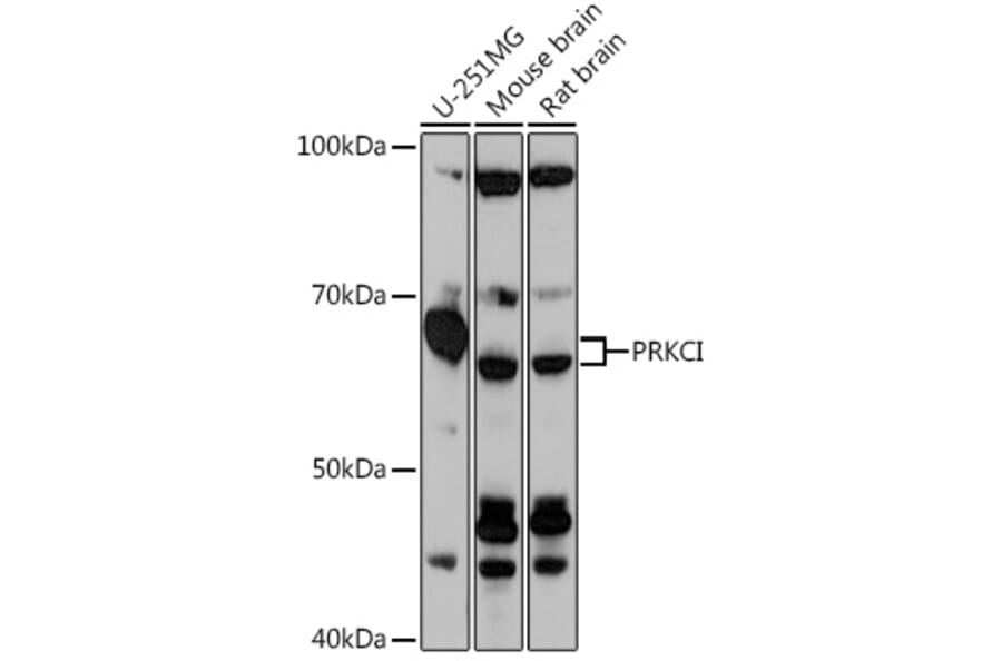 Western Blot - Anti-PKC iota Antibody (A307646) - Antibodies.com
