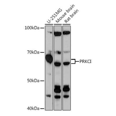 Western Blot - Anti-PKC iota Antibody (A307646) - Antibodies.com