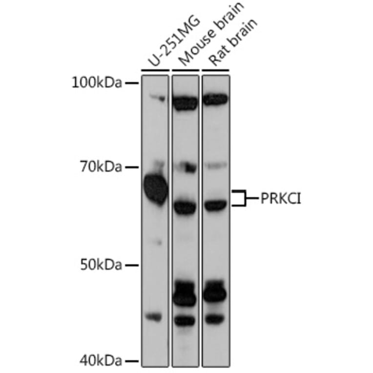 Western Blot - Anti-PKC iota Antibody (A307646) - Antibodies.com