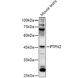 Western Blot - Anti-TCPTP Antibody (A307648) - Antibodies.com
