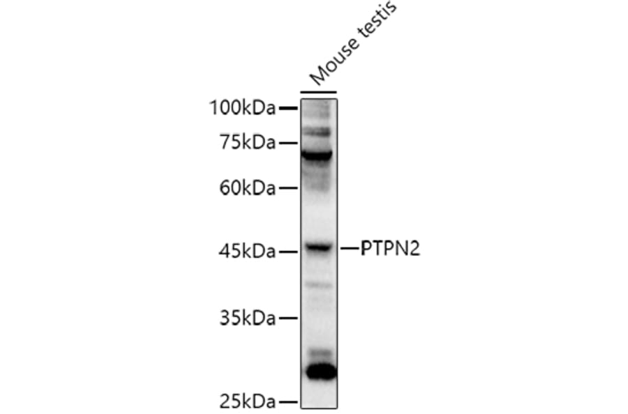 Western Blot - Anti-TCPTP Antibody (A307648) - Antibodies.com