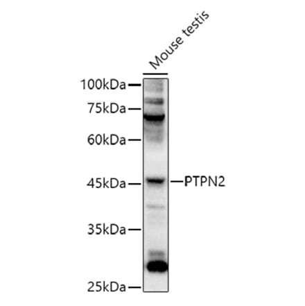 Western Blot - Anti-TCPTP Antibody (A307648) - Antibodies.com