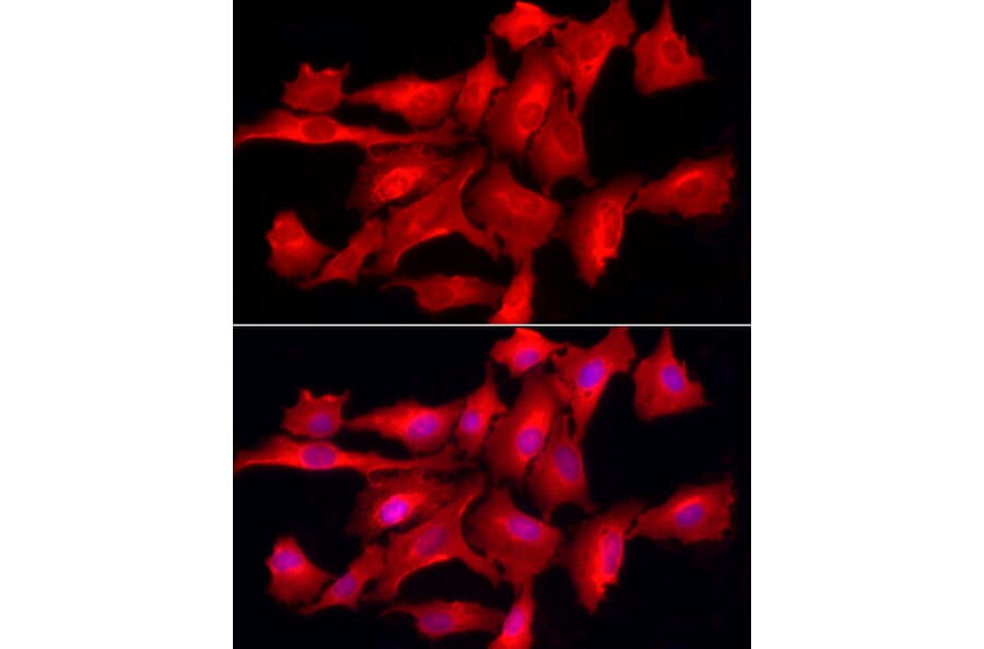 Immunofluorescence - Anti-TCPTP Antibody (A307648) - Antibodies.com