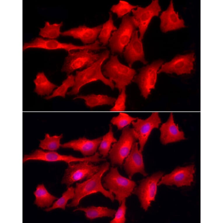 Immunofluorescence - Anti-TCPTP Antibody (A307648) - Antibodies.com