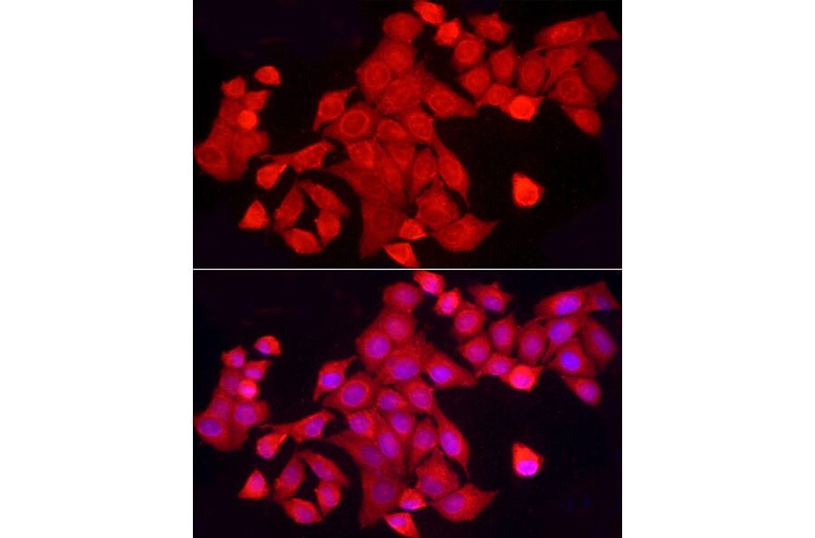Immunofluorescence - Anti-TCPTP Antibody (A307648) - Antibodies.com