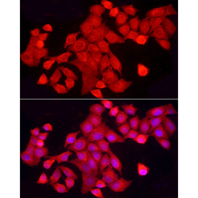 Immunofluorescence - Anti-TCPTP Antibody (A307648) - Antibodies.com