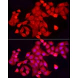 Immunofluorescence - Anti-TCPTP Antibody (A307648) - Antibodies.com