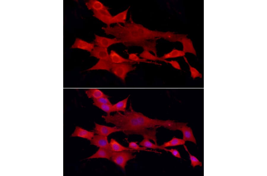 Immunofluorescence - Anti-TCPTP Antibody (A307648) - Antibodies.com