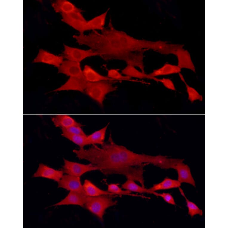 Immunofluorescence - Anti-TCPTP Antibody (A307648) - Antibodies.com