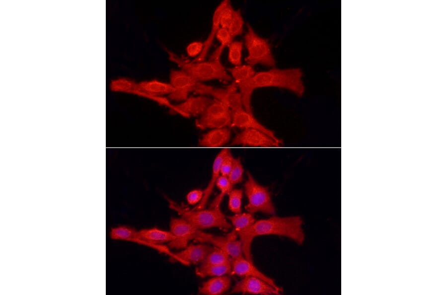 Immunofluorescence - Anti-TCPTP Antibody (A307648) - Antibodies.com