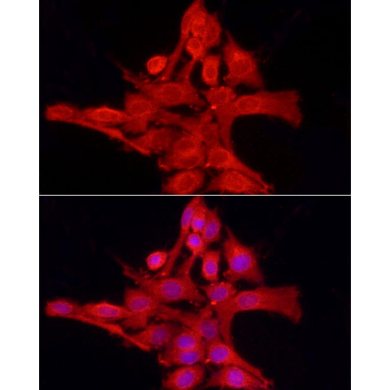 Immunofluorescence - Anti-TCPTP Antibody (A307648) - Antibodies.com