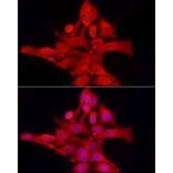 Immunofluorescence - Anti-TCPTP Antibody (A307648) - Antibodies.com