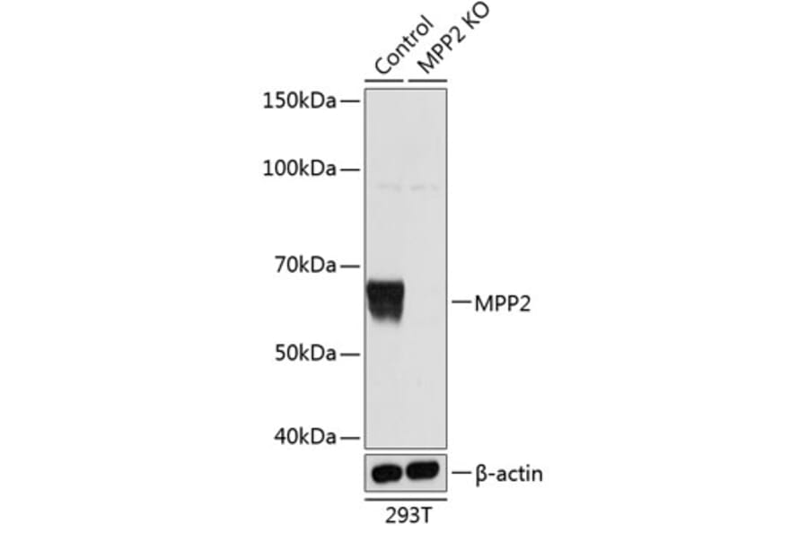 Western Blot - Anti-MPP2 / DLG2 Antibody (A307650) - Antibodies.com