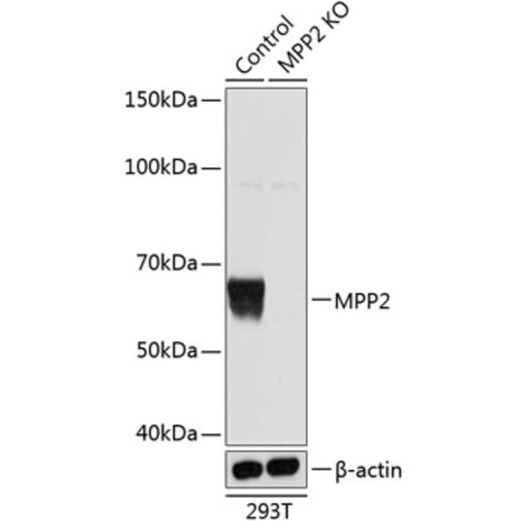 Western Blot - Anti-MPP2 / DLG2 Antibody (A307650) - Antibodies.com