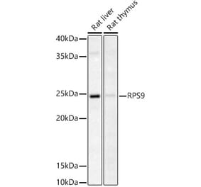 Western Blot - Anti-RPS9 Antibody (A307651) - Antibodies.com
