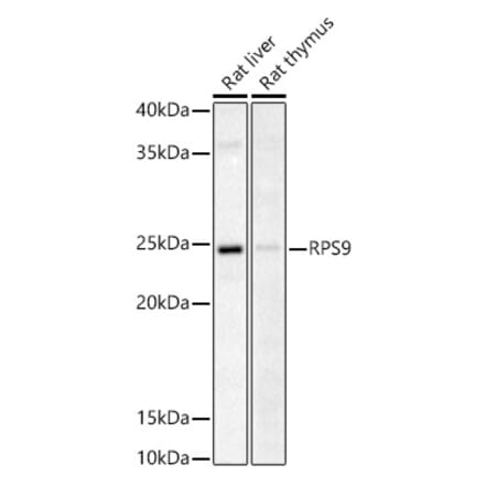 Western Blot - Anti-RPS9 Antibody (A307651) - Antibodies.com