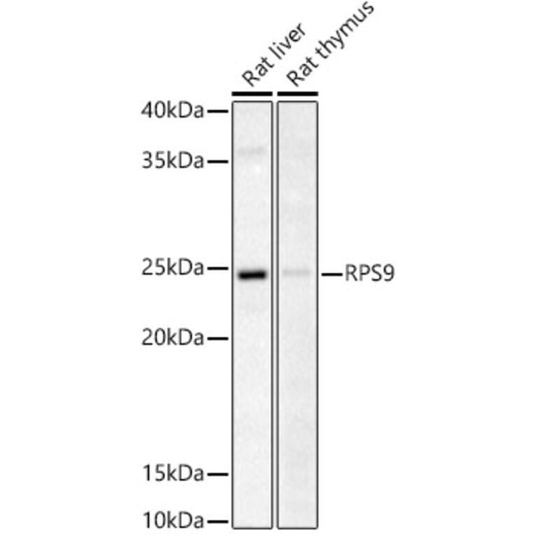 Western Blot - Anti-RPS9 Antibody (A307651) - Antibodies.com