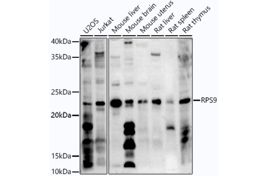 Western Blot - Anti-RPS9 Antibody (A307651) - Antibodies.com