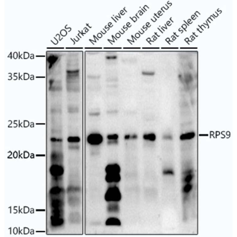 Western Blot - Anti-RPS9 Antibody (A307651) - Antibodies.com