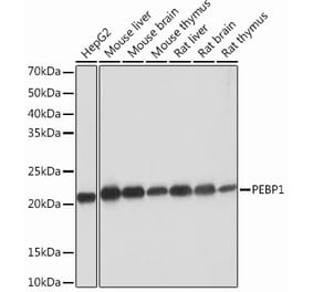 Western Blot - Anti-RKIP Antibody [ARC0704] (A307652) - Antibodies.com