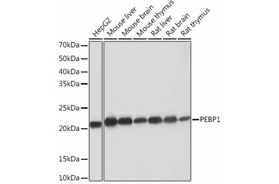 Western Blot - Anti-RKIP Antibody [ARC0704] (A307652) - Antibodies.com