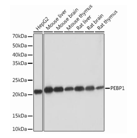 Western Blot - Anti-RKIP Antibody [ARC0704] (A307652) - Antibodies.com