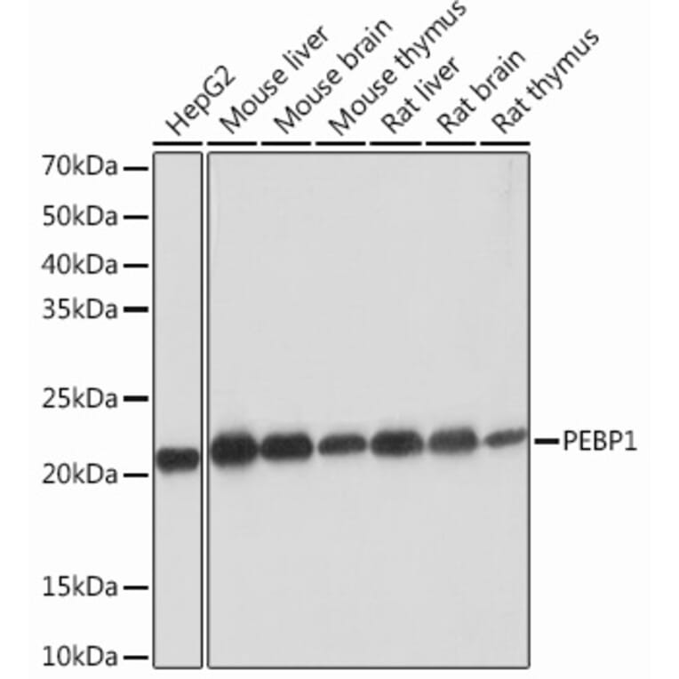 Western Blot - Anti-RKIP Antibody [ARC0704] (A307652) - Antibodies.com
